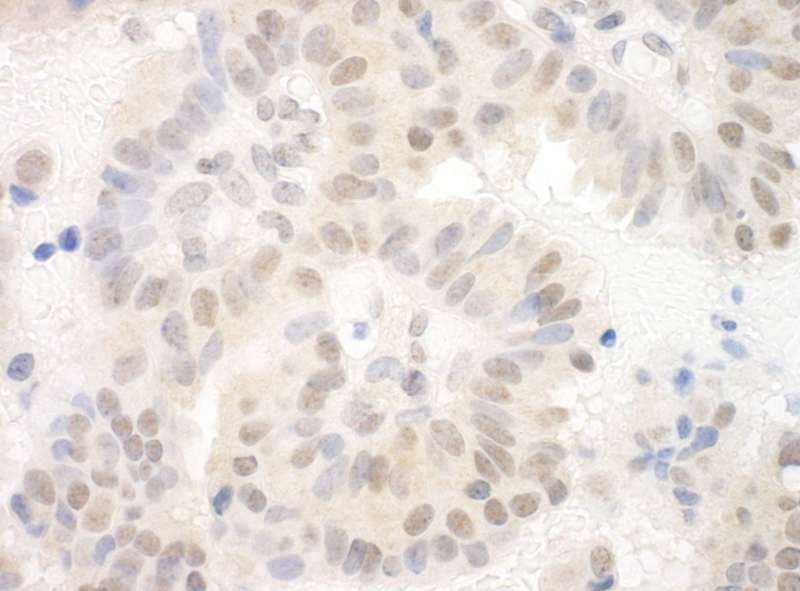 SAP130 Antibody (aa325-375)