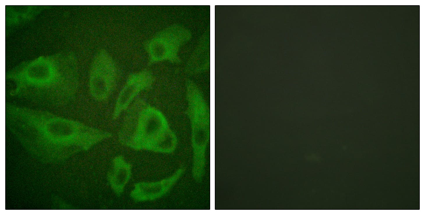 CD95 / FAS Antibody (aa257-306)