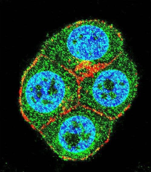 Polyclonal Rabbit anti-Human BTRCP / BETA-TRCP Antibody (aa17-52, IHC, IF, WB)