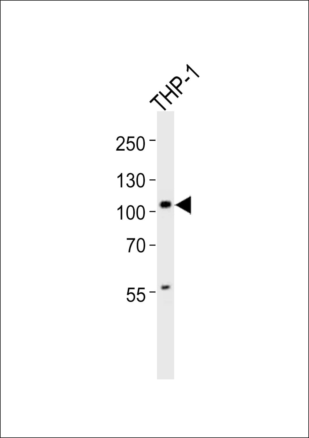 Polyclonal Rabbit anti-Human DZIP1 Antibody (aa747-781, WB)