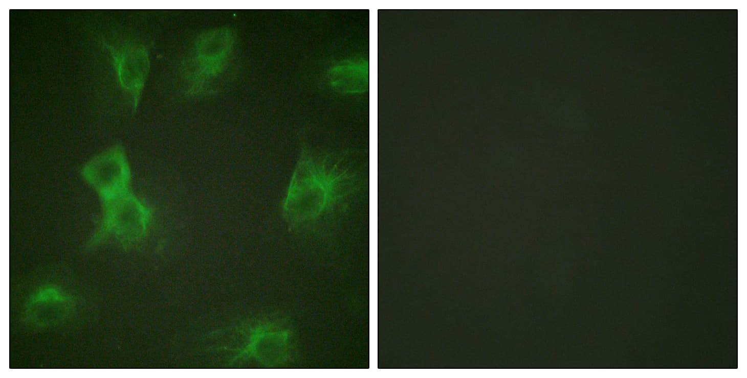 Polyclonal Rabbit anti-Human HRS / HGS Antibody (phospho-Tyr334, IHC, IF, WB)