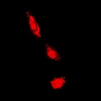 PKC Iota + PKC Zeta Antibody (Internal)