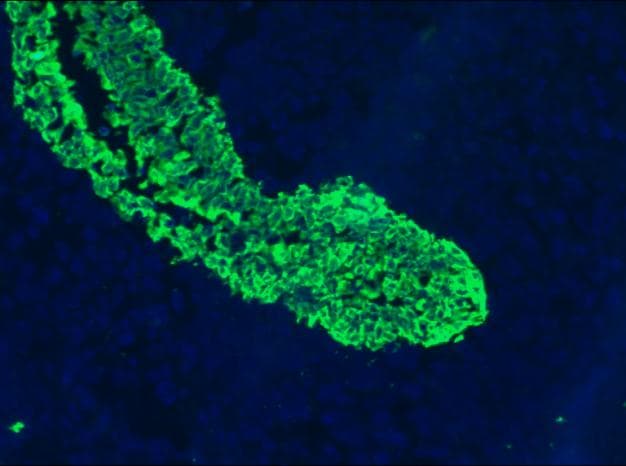 IHC-plus™ Cytokeratin 5+8 Antibody (clone RCK102)