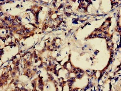 Polyclonal Rabbit anti-Human Gastrin Releasing Peptide Antibody (aa31-98)