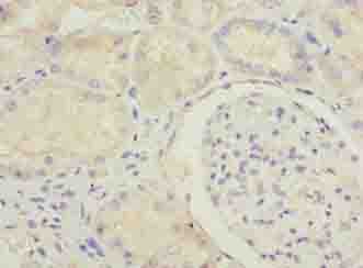 MED22 Antibody