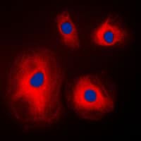 Polyclonal Rabbit anti-Human RPS4X Antibody (Internal, IF, WB)