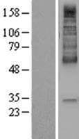 SLC16A1 / MCT1 Protein (Over-Expression Lysate Myc-DDK (Flag))