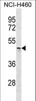 CHST6 Antibody (aa296-325)