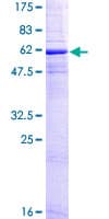 Human CD20 Protein (Recombinant GST)