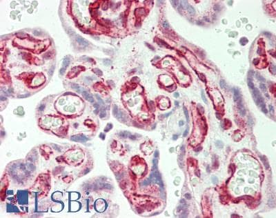 IHC-plus™ GAB2 Antibody (aa104-153)