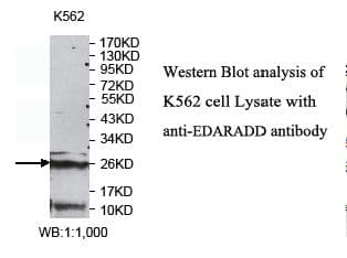 Polyclonal Rabbit anti-Human EDARADD Antibody (aa1-127, IHC, WB)
