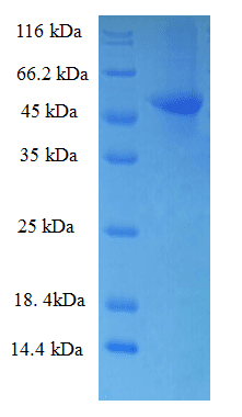 Human RBKS / Ribokinase Protein (Recombinant His-SUMO)
