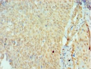 SSX2 Antibody (aa1-188)