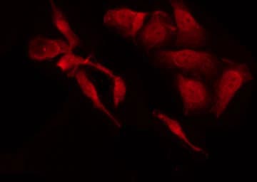E2F1 Antibody