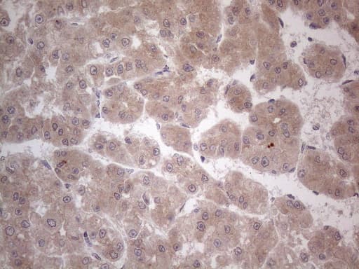 Monoclonal Mouse anti-Human ANGPTL8 / Betatrophin Antibody (clone OTI4G8, Carrier-free, aa22-198, IHC)