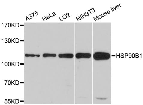 HSP90B1 / GP96 / GRP94 Antibody