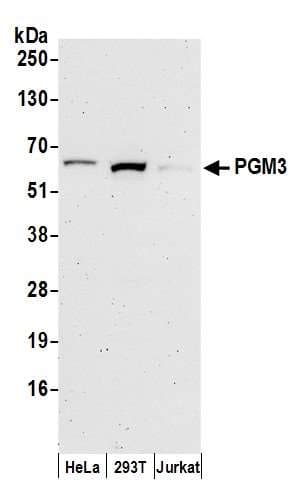 PGM3 Antibody (aa492-542)