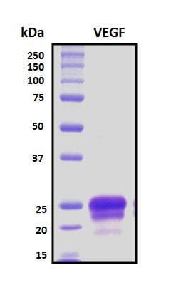 Human VEGFA / VEGF Protein (Recombinant His, N-Terminal)