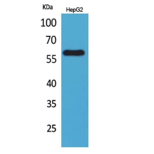 ACCN3 / ASIC3 Antibody (191-240 aa, Internal)