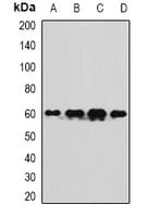 IHC-plus™ Polyclonal Rabbit anti-Human UBXD9 / ASPL Antibody (IHC, IF, WB)