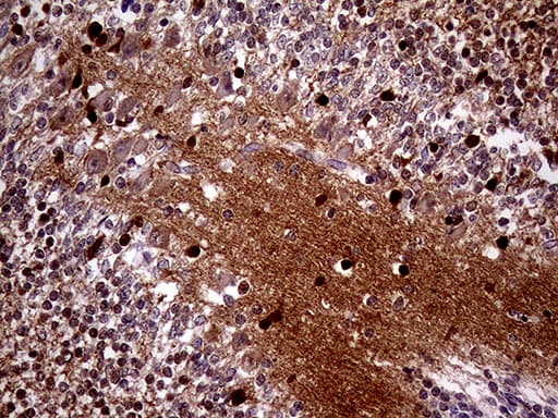 Monoclonal Mouse anti-Human MAPT / Tau Antibody (clone OTI6G3, Carrier-free, aa623-758, IHC, WB)