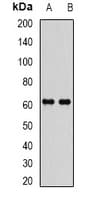 EPHX2 / Epoxide Hydrolase 2 Antibody