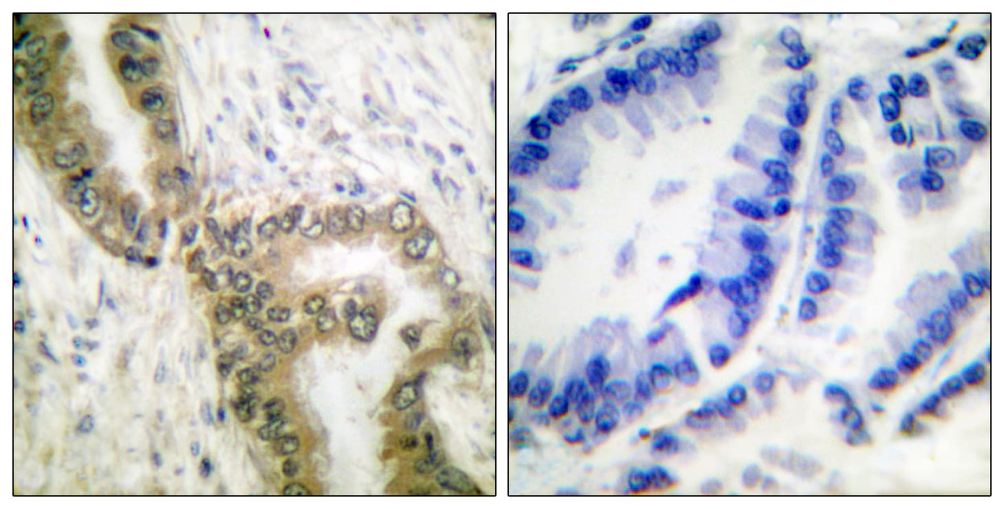 TP53 / p53 Antibody (Acetyl-Lys386)