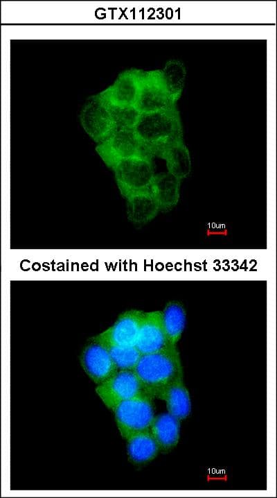 PPFIBP2 Antibody (aa120-392)