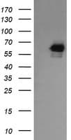 Monoclonal Mouse anti-Human RIOK2 Antibody (clone OTI3E11, IHC, IF, WB)