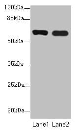SPTLC3 / C20orf38 Antibody