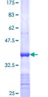 Human CYFIP2 / PIR121 Protein (Recombinant GST, N-terminus)