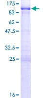 Human PES1 Protein (Recombinant GST)