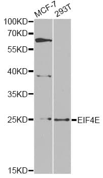 Polyclonal Rabbit anti-Human EIF4E Antibody (IF, WB)