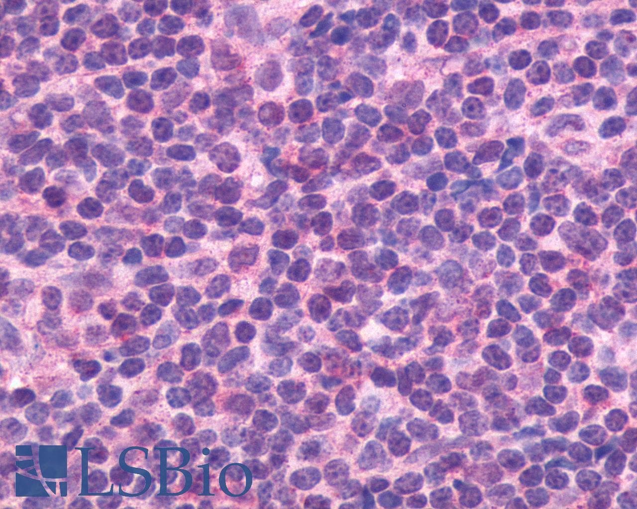IHC-plus™ Polyclonal Rabbit anti-Human CXCR5 Antibody (C-Terminus, IHC)