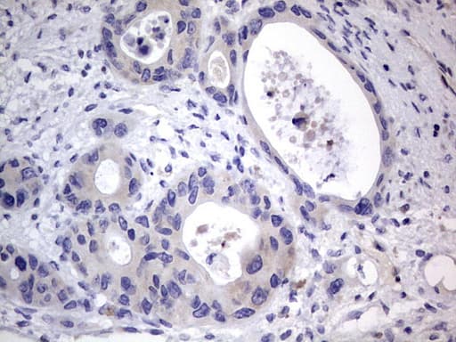 PRX-1 / PRRX1 Antibody (clone OTI1E10)
