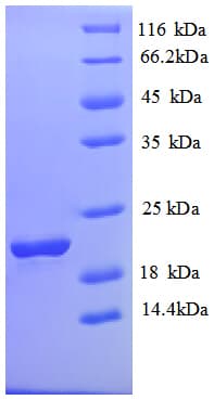 Human SLC41A2 Protein (Recombinant His)