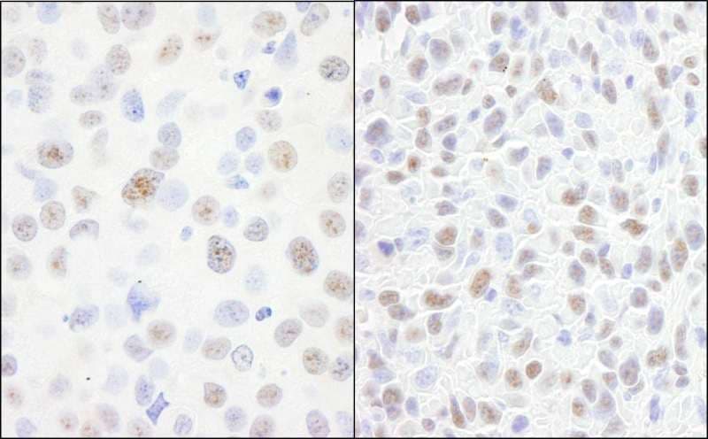Polyclonal Rabbit anti-Human DDX21 Antibody (aa725-C-term, WB)