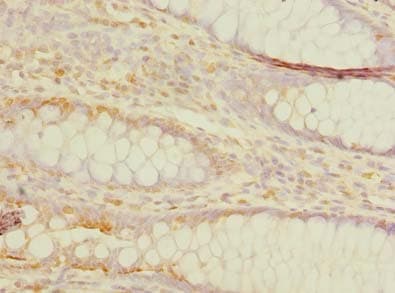 Polyclonal Rabbit anti-Human TMEM59L Antibody (IHC, WB)