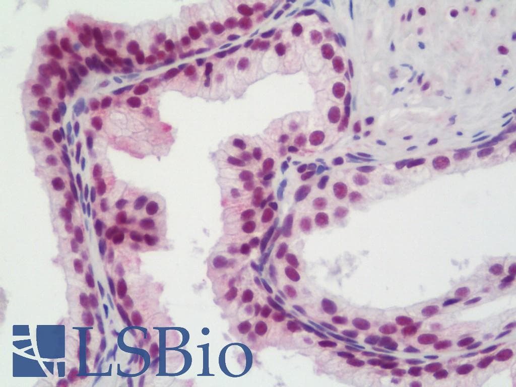 IHC-plus™ Polyclonal Rabbit anti-Human NCOA2 / TIF2 Antibody (aa1400-C-term, IHC)