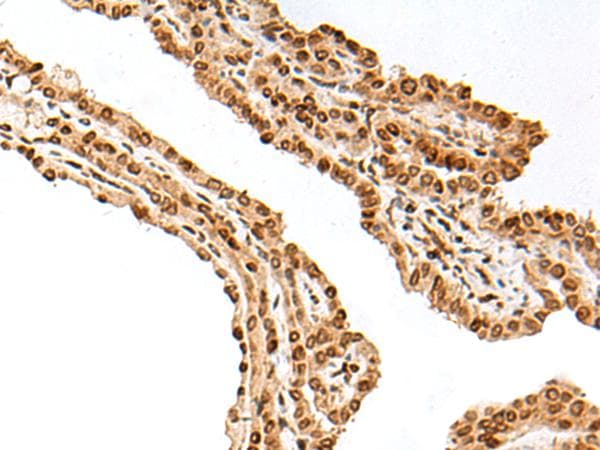Polyclonal Rabbit anti-Human FANCB / FAB Antibody (IHC)