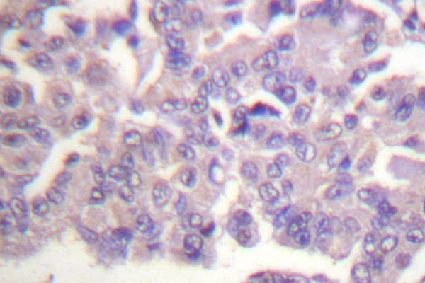 FLNA / Filamin A Antibody (Arg2146)