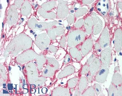 IHC-plus™ UBTD2 Antibody