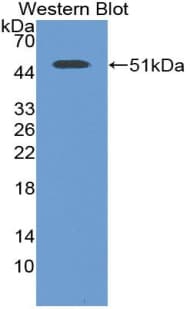 ENO2 / NSE Antibody (aa1-434, clone C20, APC)