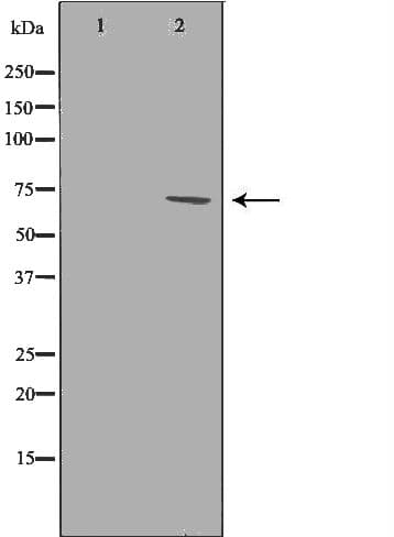 IL23R Antibody