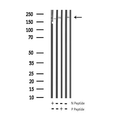 BRCA1 Antibody (phospho-Ser1524)