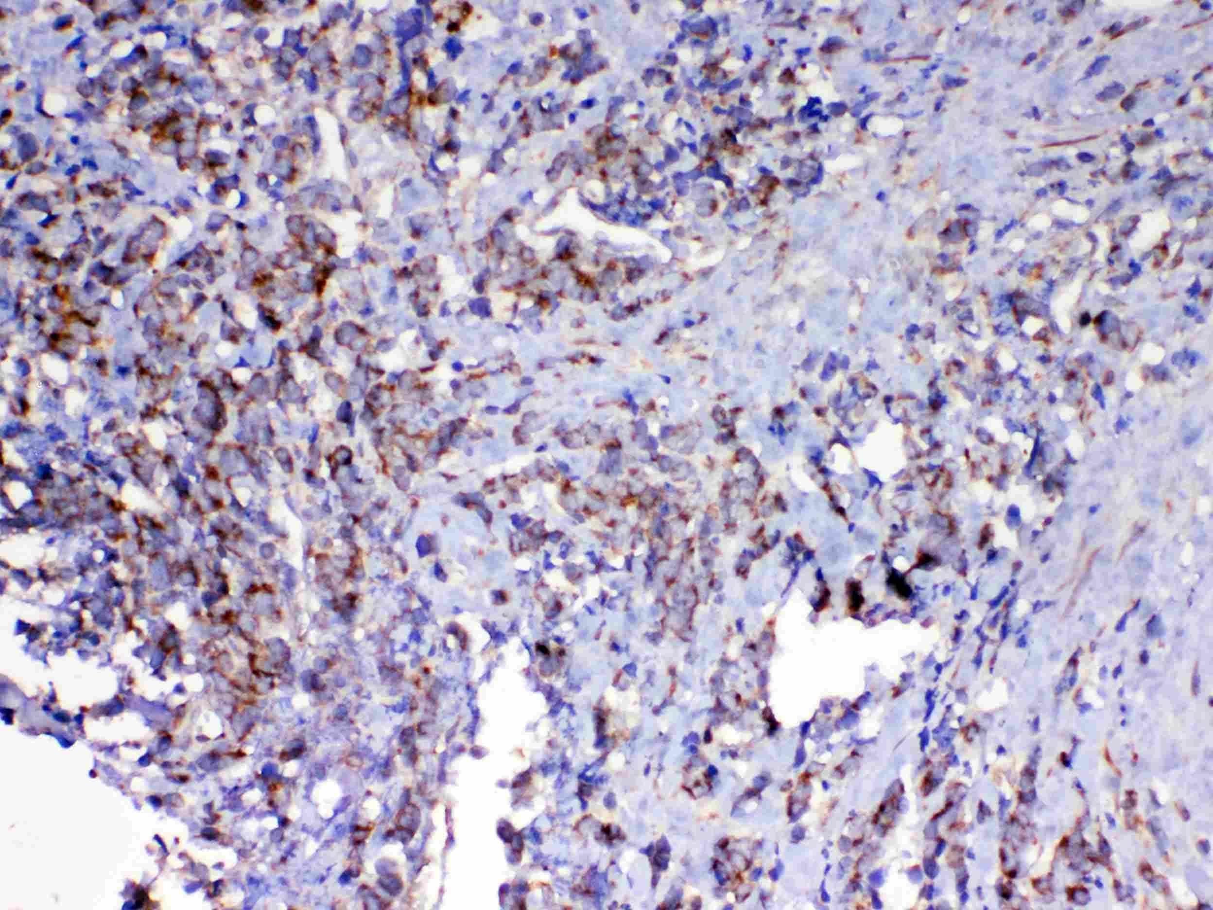 VISA / MAVS Antibody