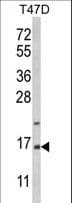 PEA15 / PEA-15 Antibody (aa86-115)