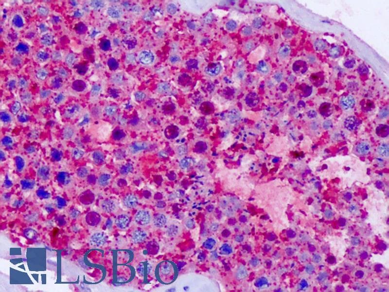 IHC-plus™ CELSR1 Antibody (C-Terminus)