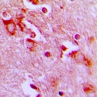 PIP4K2A / PIPK Antibody
