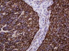 HSPD1 / HSP60 Antibody (clone OTI3G10)